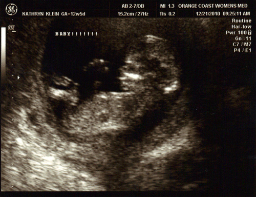 12 week ultrasound pic